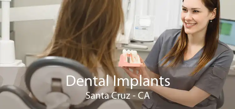 Dental Implants Santa Cruz - CA