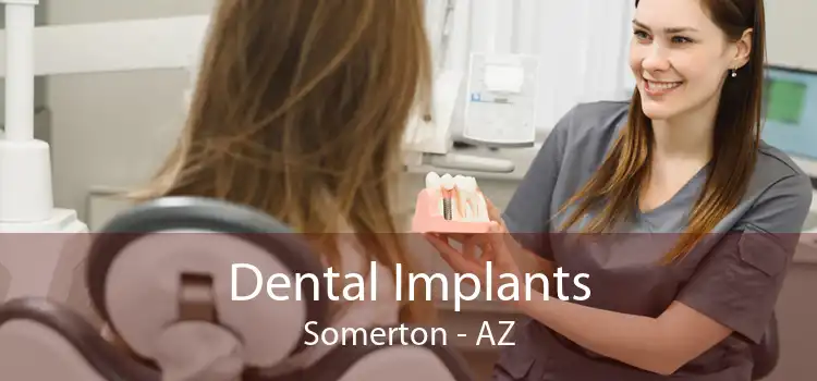 Dental Implants Somerton - AZ