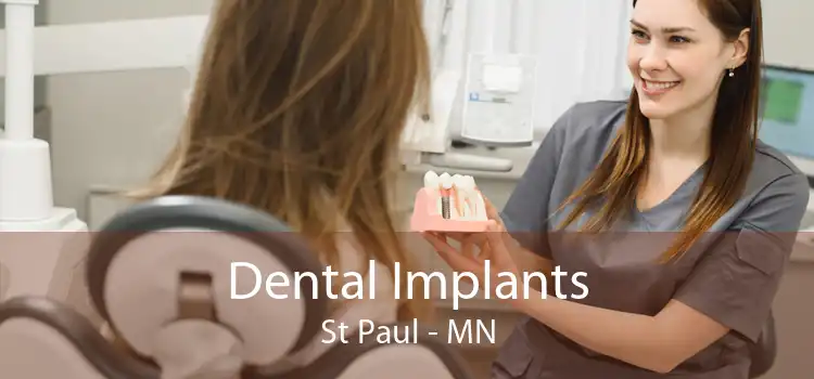 Dental Implants St Paul - MN
