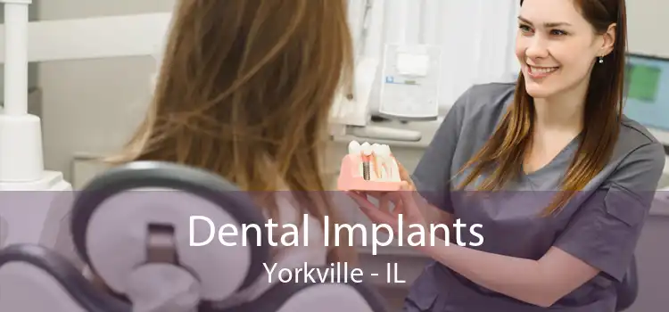 Dental Implants Yorkville - IL