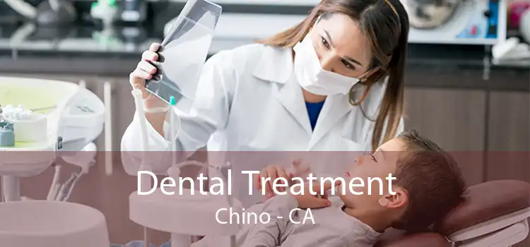 Dental Treatment Chino - CA