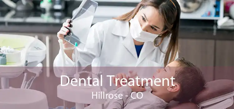 Dental Treatment Hillrose - CO