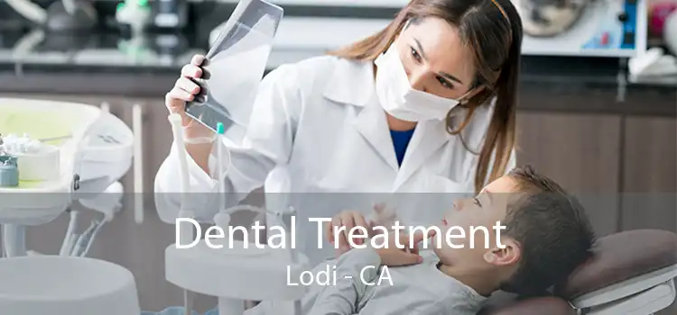 Dental Treatment Lodi - CA