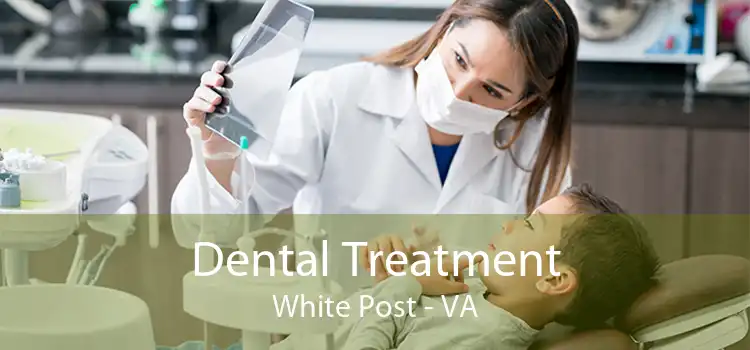 Dental Treatment White Post - VA