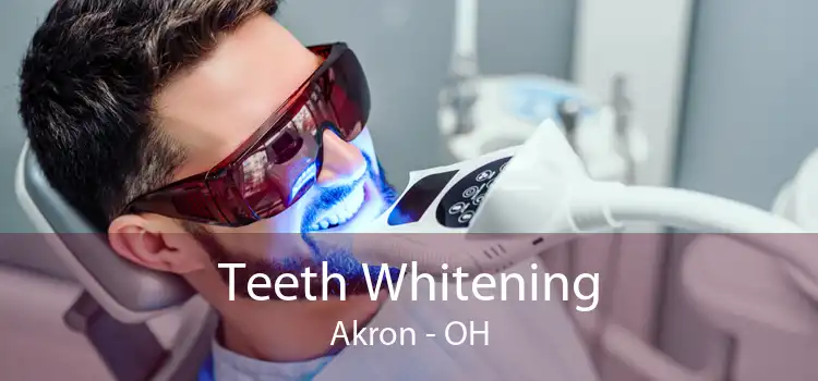 Teeth Whitening Akron - OH