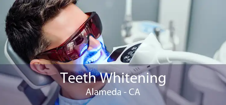 Teeth Whitening Alameda - CA