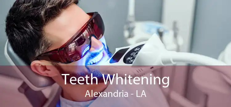 Teeth Whitening Alexandria - LA