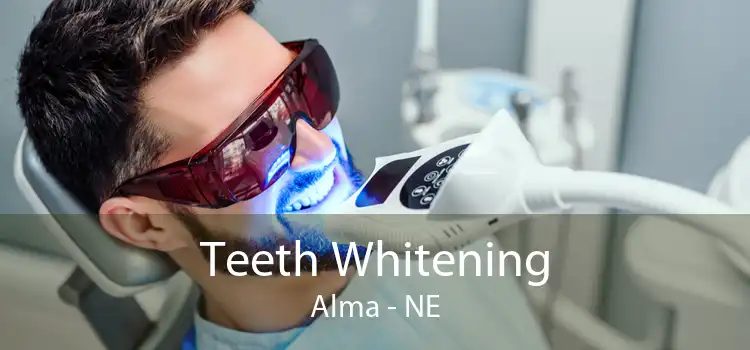 Teeth Whitening Alma - NE