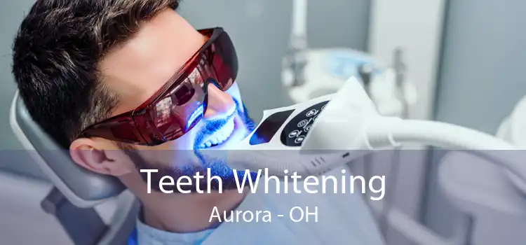Teeth Whitening Aurora - OH