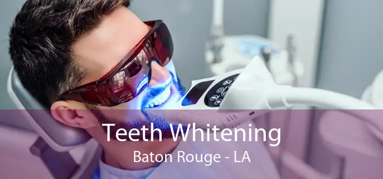 Teeth Whitening Baton Rouge - LA