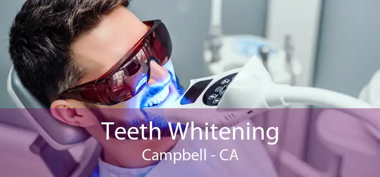 Teeth Whitening Campbell - CA