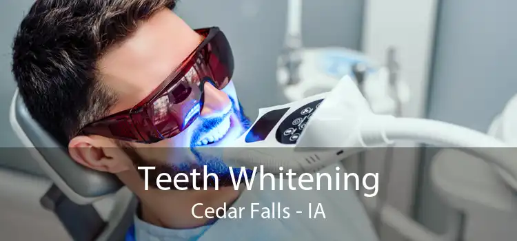 Teeth Whitening Cedar Falls - IA