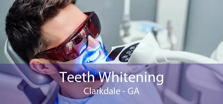Teeth Whitening Clarkdale - GA