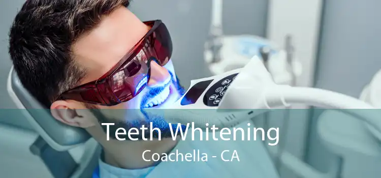 Teeth Whitening Coachella - CA