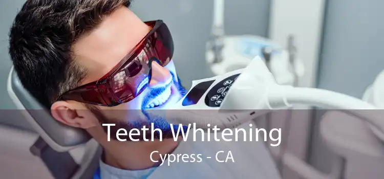 Teeth Whitening Cypress - CA