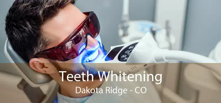 Teeth Whitening Dakota Ridge - CO