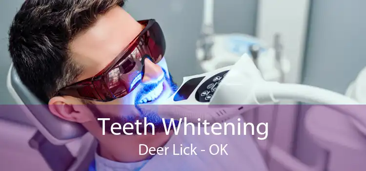 Teeth Whitening Deer Lick - OK