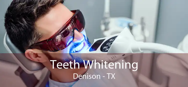 Teeth Whitening Denison - TX