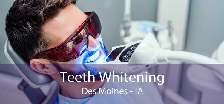 Teeth Whitening Des Moines - IA