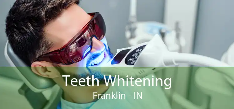 Teeth Whitening Franklin - IN