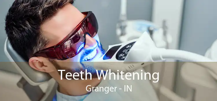 Teeth Whitening Granger - IN