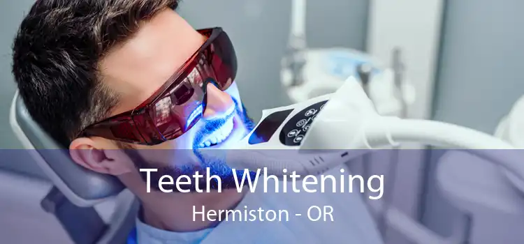 Teeth Whitening Hermiston - OR