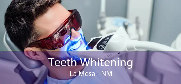 Teeth Whitening La Mesa - NM