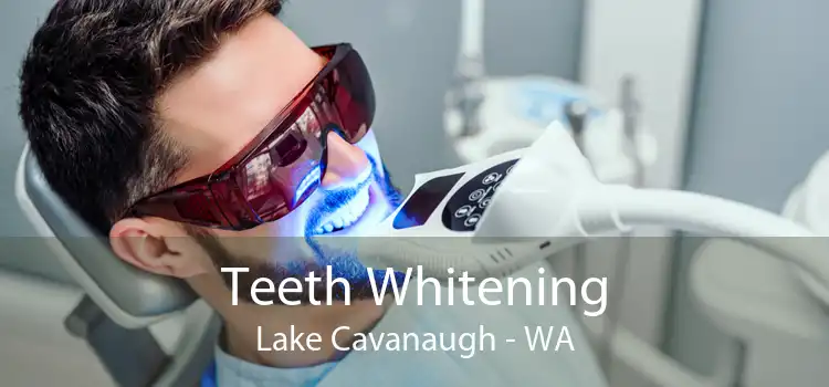 Teeth Whitening Lake Cavanaugh - WA