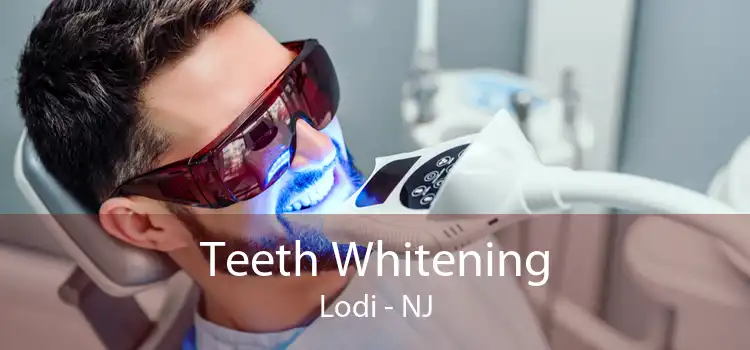 Teeth Whitening Lodi - NJ