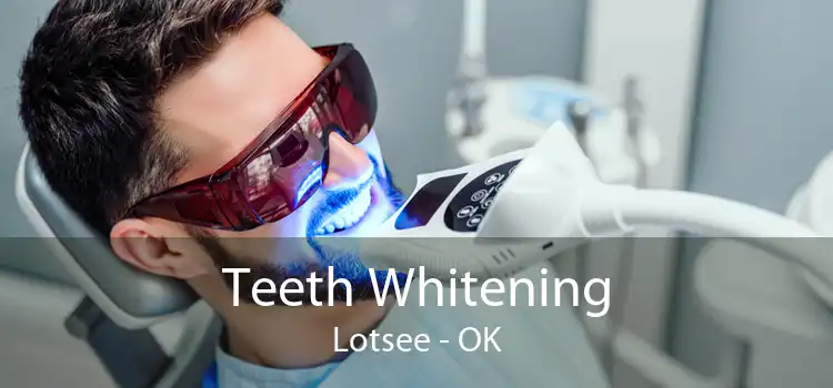 Teeth Whitening Lotsee - OK
