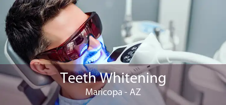 Teeth Whitening Maricopa - AZ