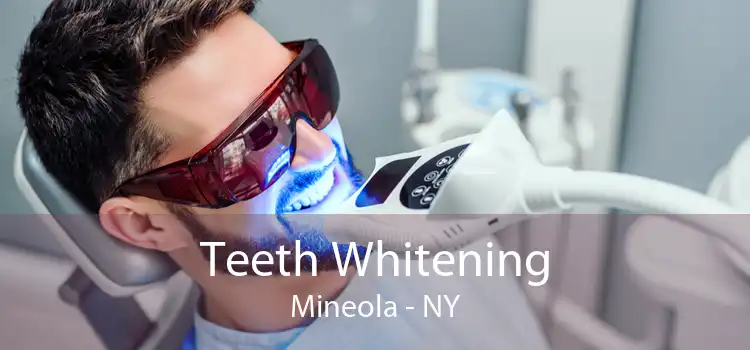 Teeth Whitening Mineola - NY