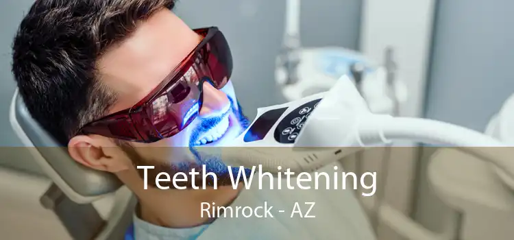 Teeth Whitening Rimrock - AZ