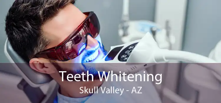 Teeth Whitening Skull Valley - AZ