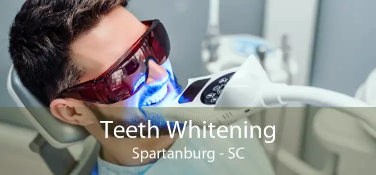 Teeth Whitening Spartanburg - SC