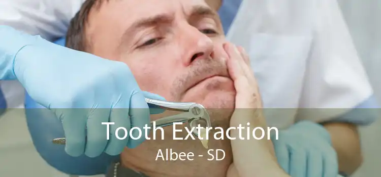 Tooth Extraction Albee - SD