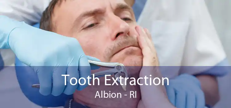 Tooth Extraction Albion - RI