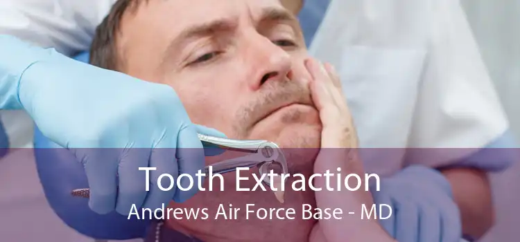 Tooth Extraction Andrews Air Force Base - MD