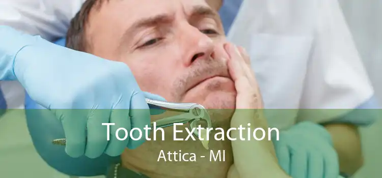 Tooth Extraction Attica - MI