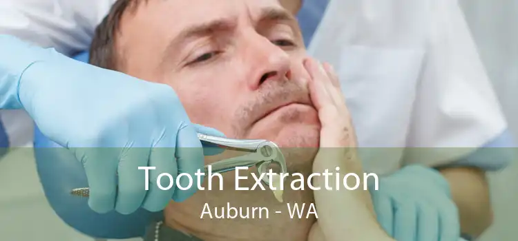 Tooth Extraction Auburn - WA