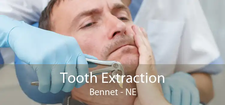 Tooth Extraction Bennet - NE