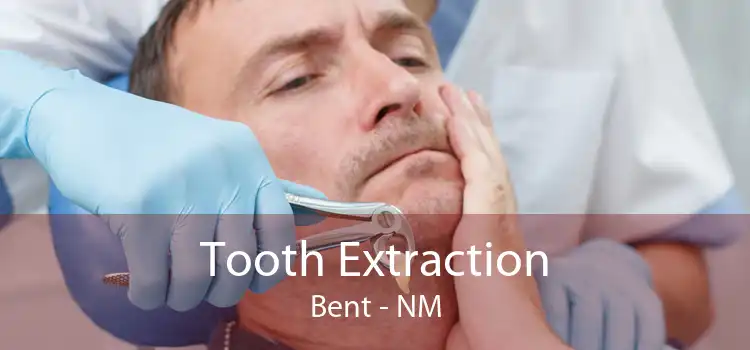 Tooth Extraction Bent - NM