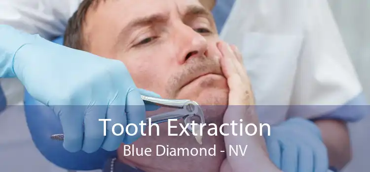 Tooth Extraction Blue Diamond - NV
