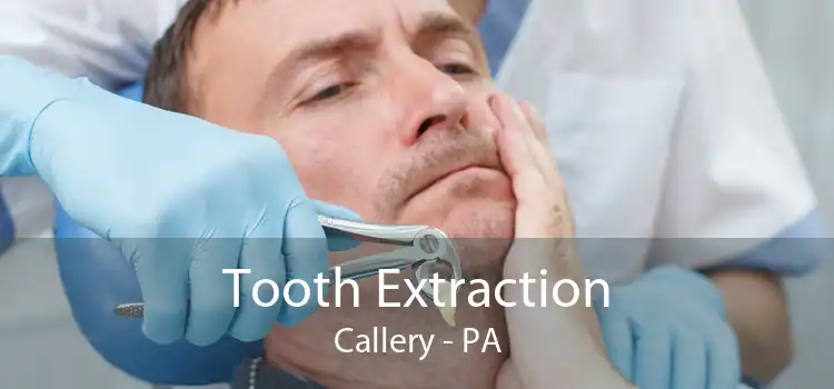 Tooth Extraction Callery - PA