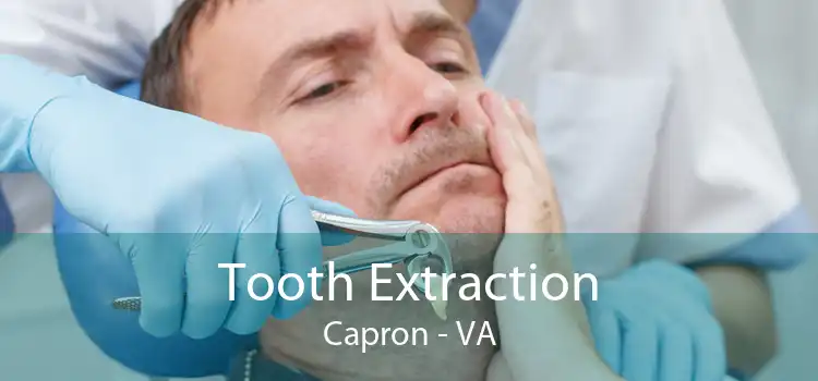 Tooth Extraction Capron - VA