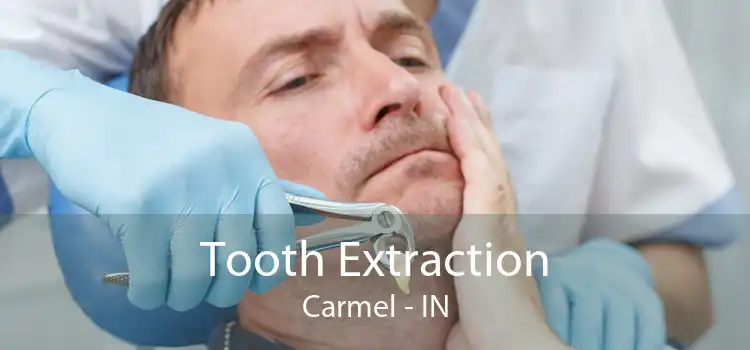 Tooth Extraction Carmel - IN