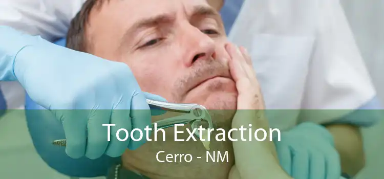 Tooth Extraction Cerro - NM