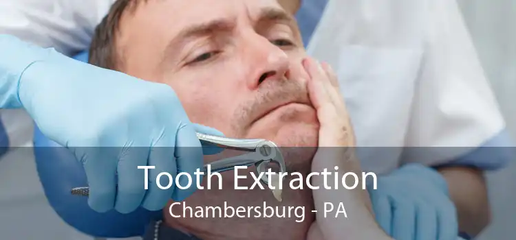 Tooth Extraction Chambersburg - PA
