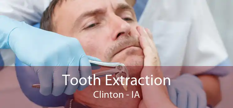 Tooth Extraction Clinton - IA