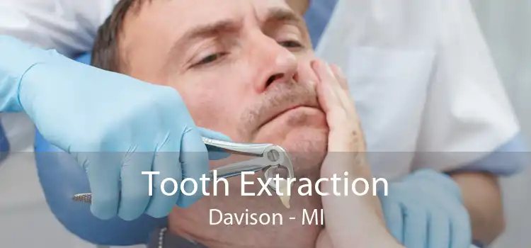Tooth Extraction Davison - MI